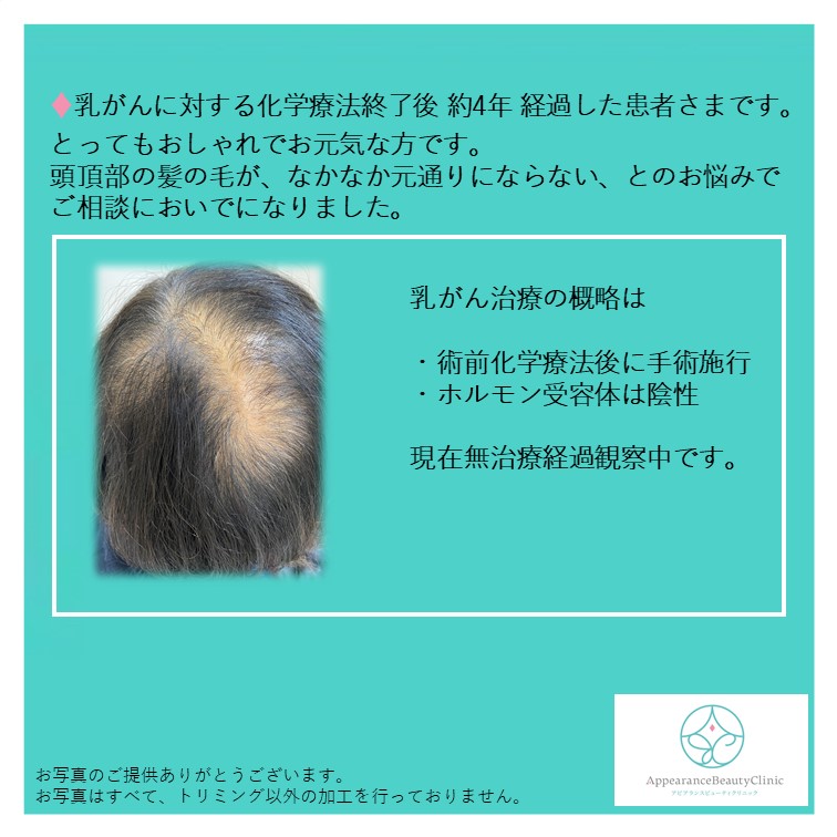 アピアランスケア 今日は抗がん剤治療後の髪の毛のケアです アピアランスビューティクリニック アピアランスケア 今日は抗がん剤治療後の髪の毛のケアです アピアランスビューティクリニック